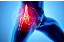 髋关节置换手术后，需要注意什么？图片