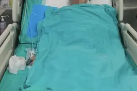 长期啤酒+烧烤！男子突然发烧腹痛后住进ICU，夏季饮食要注意图片