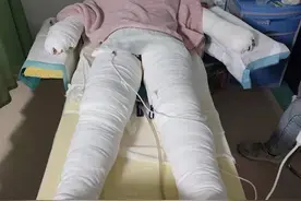 帮到底追踪｜众多网友牵挂烧伤准妈妈，百余名热心人士伸出援手图片