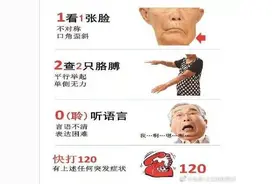 脑梗死的前驱症状有哪些图片
