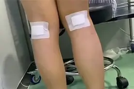这项网红瘦腿手术被国家紧急叫停！各地应立即整顿图片