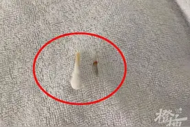 25岁姑娘喝了一碗鸡汤被骨头卡住 结果连夜被送来杭州做了全麻插管手术图片