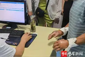 酷暑天，这双手却被严重冻伤.......图片