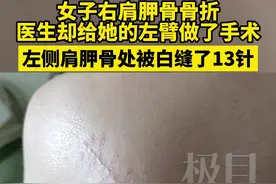右臂骨折给左臂手术，孝昌县第一人民医院：已停止当事医生处方权图片