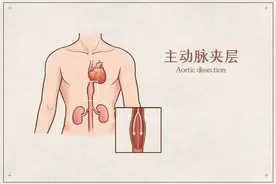 十年磨剑，锋刃已成！中山医院心脏大血管手术团队摘取心外科手术“皇冠上的明珠”图片