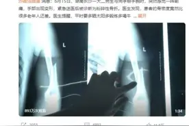 大二男生掰手腕时粉碎性骨折！你的骨头没想象的那么“硬”图片