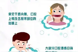 得了口腔溃疡，你还在用针挑破？错！应该做到这8点图片