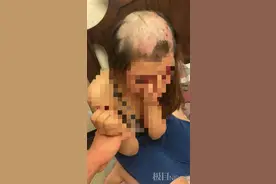 女子回应“遭丈夫剃秃头承认出轨”：被逼的，河北保定警方：正在调查图片