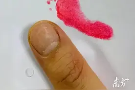 23周+4天！佛山最低胎龄超早早产儿顺利出院图片