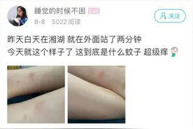 两分钟就中招！萧山姑娘欲哭无泪：奇痒无比图片