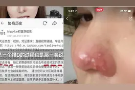 初普美容仪销售方涉“虚假宣传”被罚30万 产品“FDA认证”被指造假或存烫伤风险图片