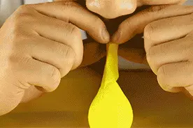感觉孩子越长越丑，去医院一查居然是病...图片