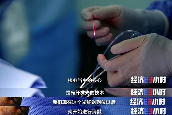 重大利好！不开颅治疗脑肿瘤，费用预计为国外的5%