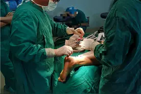 器械穿针引线实施微创手术 医生20多分钟接好患者断裂跟腱图片