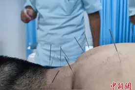 六旬日本归侨回成都开诊所：中医针灸需要国际间交流合作图片