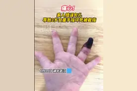 创可贴别乱用！家人错误包扎致3岁女童手指坏死，网友：心疼图片