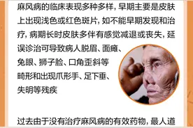 李桓英一直与之奋战的麻风病，到底有多可怕？图片