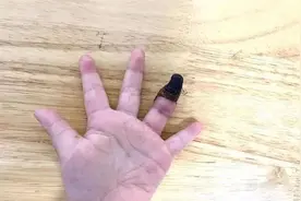 3岁女童手指没了，只因在伤口上……很多人都这样图片