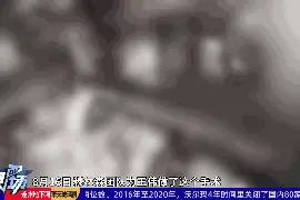 男子颅内取出6厘米长的活虫，疑是饮食习惯惹的祸图片