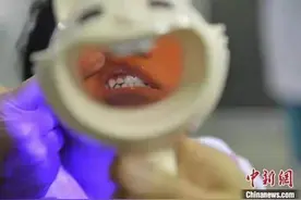 定制牙套9块9还包邮！整牙自由就此实现？图片