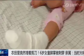 揪心！农田里竟然埋剪刀！6岁女童脚掌被刺穿图片