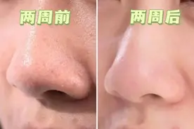 滚蛋吧，黑头君！中国「死海泥」面膜，“吸”走脏东西，肌肤焕然一新图片