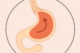 突然打嗝又止不住？快来试试这3种科学的方法图片