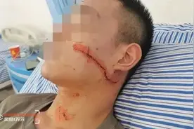 凌晨，一个满身是血的小伙跑进店铺 真相被全网怒赞图片