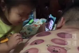 爸爸拔罐回来被女儿看到 背部被女儿画成了“动物园”图片