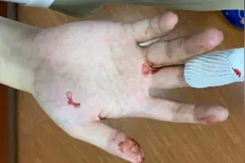 深圳市民曝大疆无人机“一键返航”成“一键炸机”图片