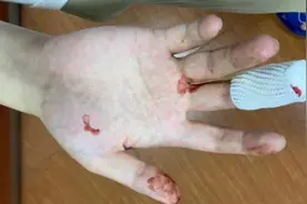 深圳市民曝大疆无人机“一键返航”成“一键炸机”图片