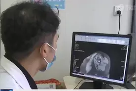 现挤羊奶新鲜有营养？老人常年喝羊奶，却因此住进了医院……图片