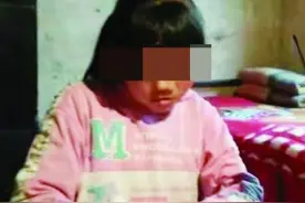 女婴因面部缺陷被弃 养父捡回抚养18年后考上医学院图片