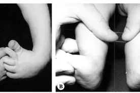 一只X线片上骨骼排列完美的脚？图片