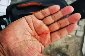 可恶！共享电单车坐垫里藏刀片，安徽蚌埠一市民被划伤图片