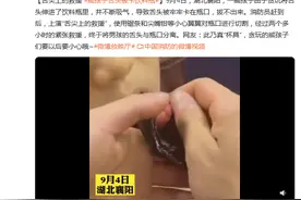 舌尖上的救援？熊孩子舌头被卡饮料瓶图片