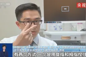 教程！在家自测是否脱发图片