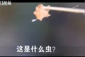 暑期打工归来大学生眼睑瘙痒，竟是感染了阴虱