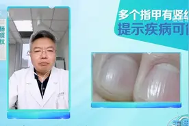 指甲变成这样的人注意了！是疾病预警哟图片