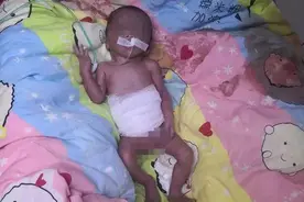 出生不久！女婴被遗弃在小区草丛，被发现时孩子全身发黑、生命垂危图片