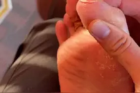 奥运冠军比赛中脚被鞋割伤，李宁回应图片