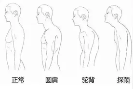 变矮2厘米，早亡风险增七成图片