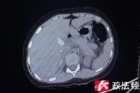 湖南4岁女童家中受伤，紧急手术抢回一命！有小孩的家庭，快看看这个东西你家有没有图片