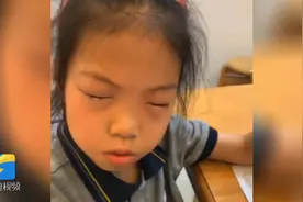 怪事！9岁女孩一做数学题眼睛就过敏 肿到睁不开眼图片