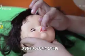 医聊达人：孩子舌系带过短的小知识视频封面