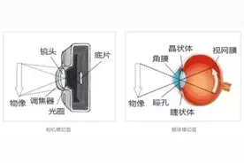 视力就是黄斑的能力，病变了很麻烦图片