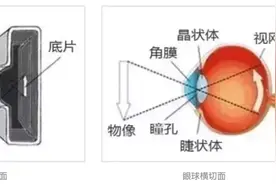 视力就是黄斑的能力，病变了很麻烦图片