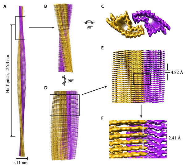 研究揭示朊病毒蛋白病理聚集多态性分子机制