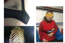 63岁女保洁遭一警院学生殴打 家属称：想给母亲一个公道图片