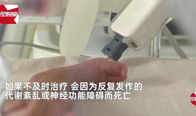 香妃同款？新生儿得罕见病全身散发一股甜香，洗都洗不掉